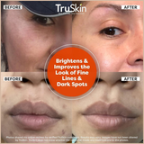 Vitamin C Face Serum with Hyaluronic Acid & Vitamin E – Brightening & Anti-Aging