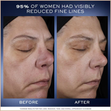 Génifique Ultimate Recovery Serum with Beta-Glucan – Radiance & Barrier Repair