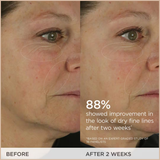 The Dewy Skin Cream Line-Plumping Moisturizer