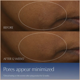 Advanced Night Repair Synchronized Multi-Recovery Complex Serum