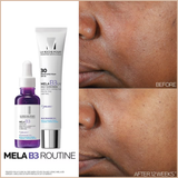 Mela B3 Serum Dark Spot Corrector – Melasyl + 10% Niacinamide – Fade Sunspots, Age Spots & Post-Acne Marks