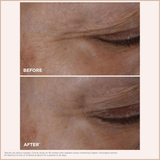 Total Eye Lift Refillable Eye Cream