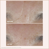 Total Eye Lift Refillable Eye Cream