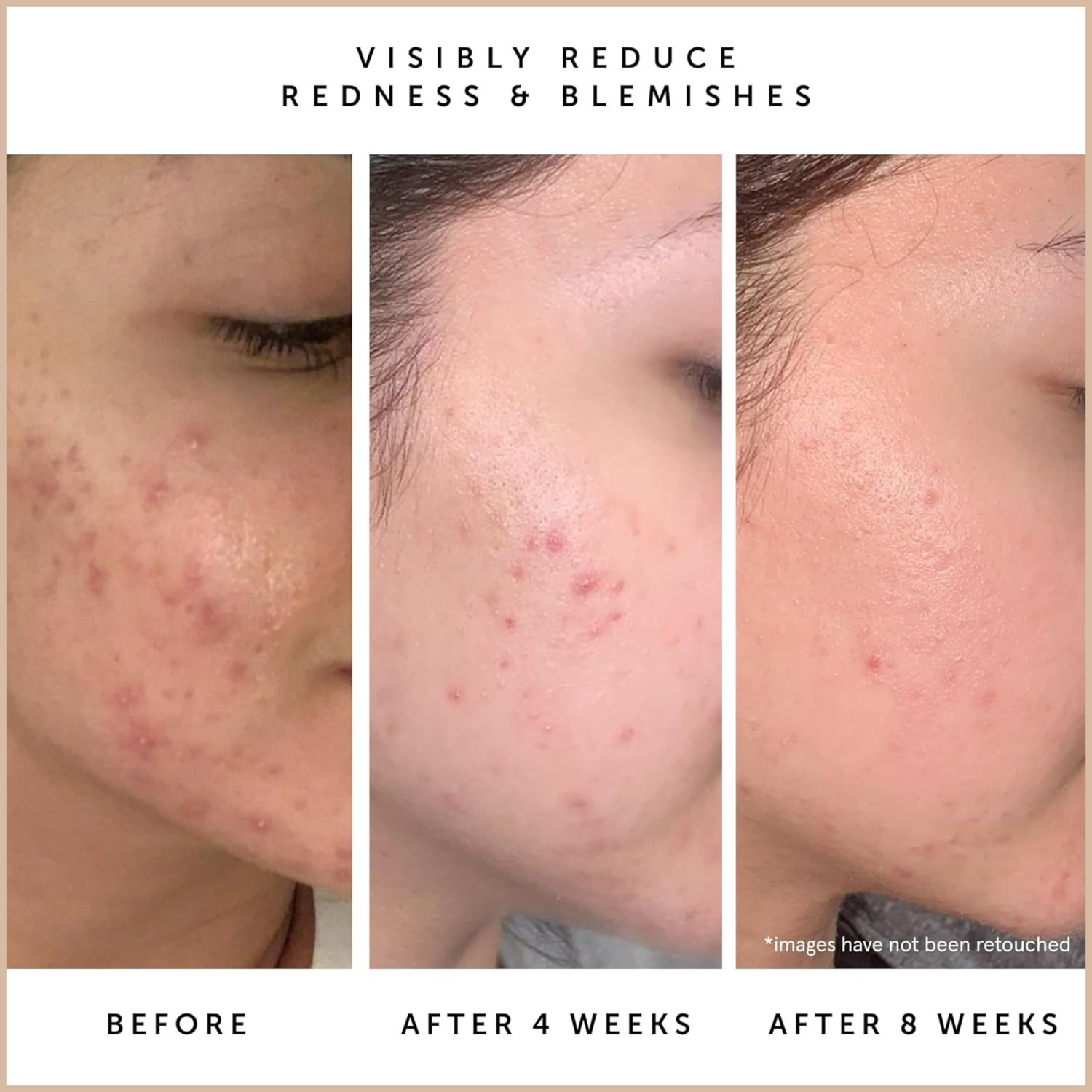 Blue Tansy & Squalane Balancing Facial Oil – Lightweight Moisture Control