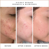 Blue Tansy & Squalane Balancing Facial Oil – Lightweight Moisture Control