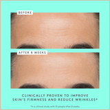 Polypeptide Firming Moisturizer