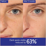 Vinoperfect Dark Spot Brightening Serum – Vitamin C Alternative