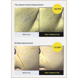 The Vita-A Retinol Shot Tightening Serum