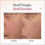 Aging Skin Facial Treatment Essence with Antioxidants