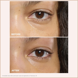 Total Eye Lift Refillable Eye Cream