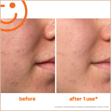 ExfoliKate Intensive Exfoliating Treatment