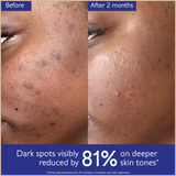 Vinoperfect Dark Spot Brightening Serum – Vitamin C Alternative